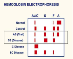 Hemoglobin Electrophoresis Interpretation Chart